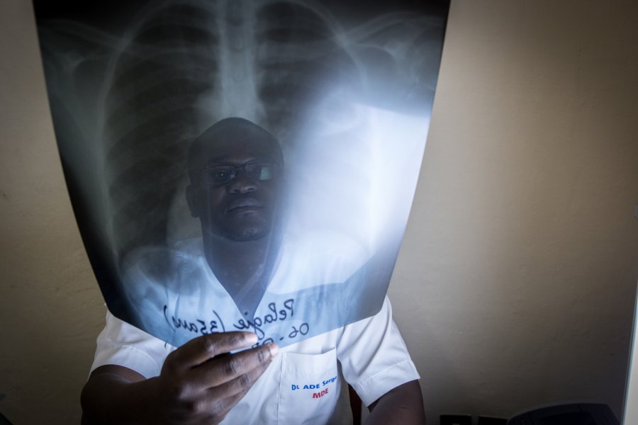Man holding lung X-ray. Credit: The Union