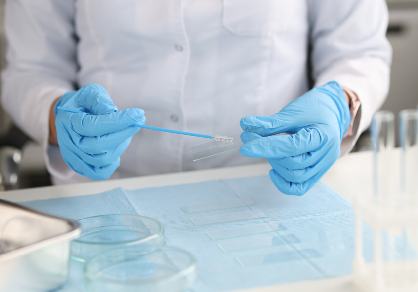Doctor in gloves holds brush for smears and glass in lab. Credit: Canva/Alexander&#039;s images