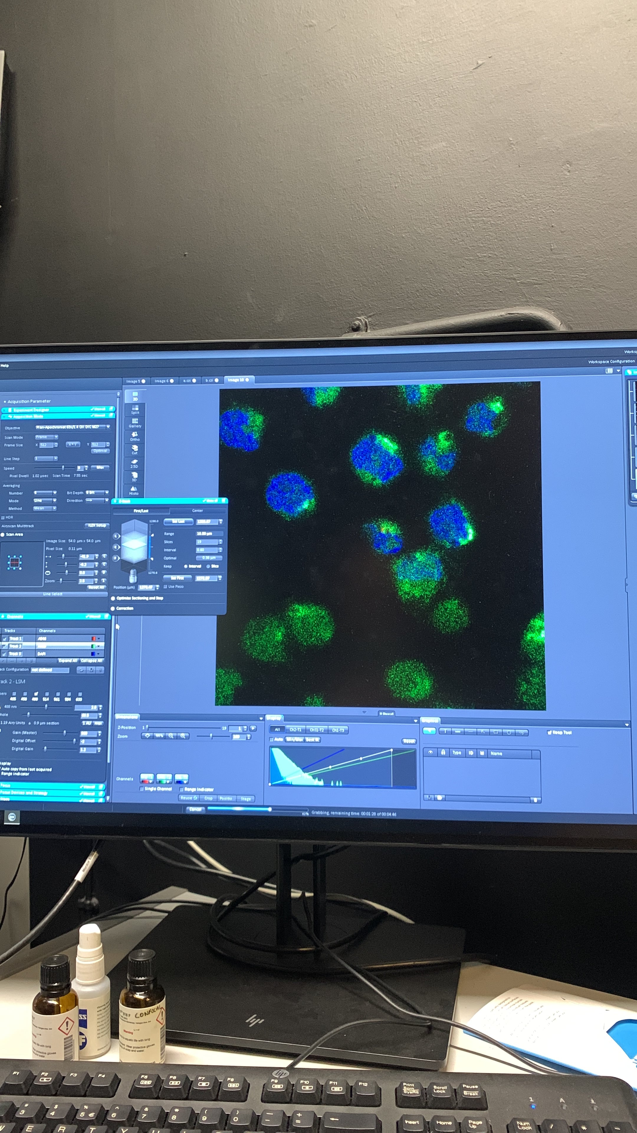 A picture of the Zeiss confocal microscope at LSHTM, imaging a B cell line, staining for the nucleus and the Golgi.