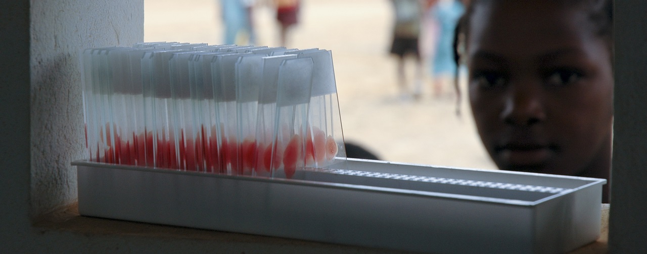 Blood-samples. Credit: Antonio Mendes