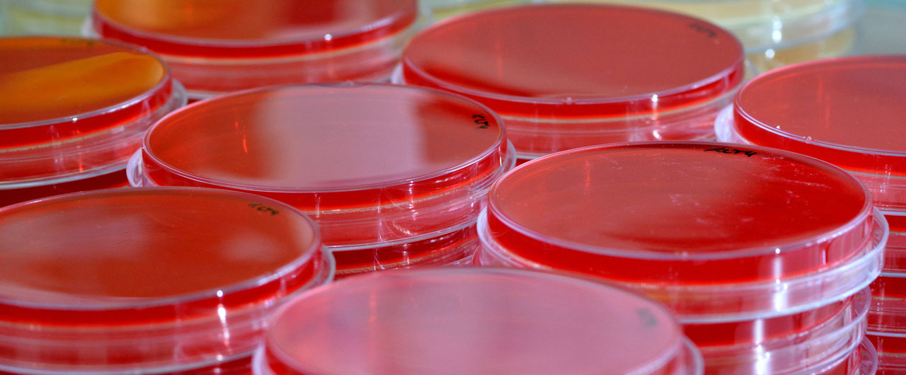 Transparent containers with blood samples in lab