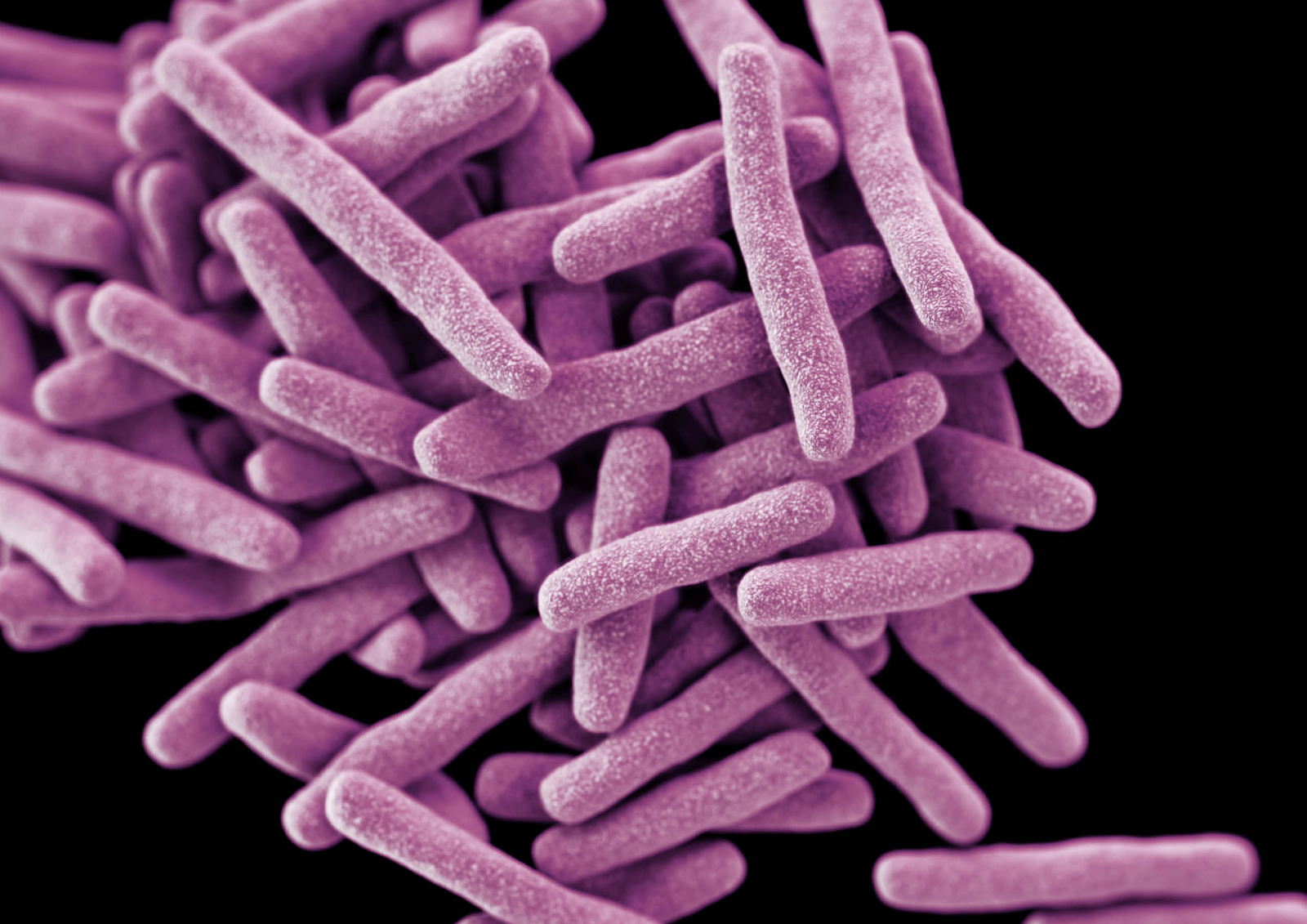 Mycobacterium tuberculosis