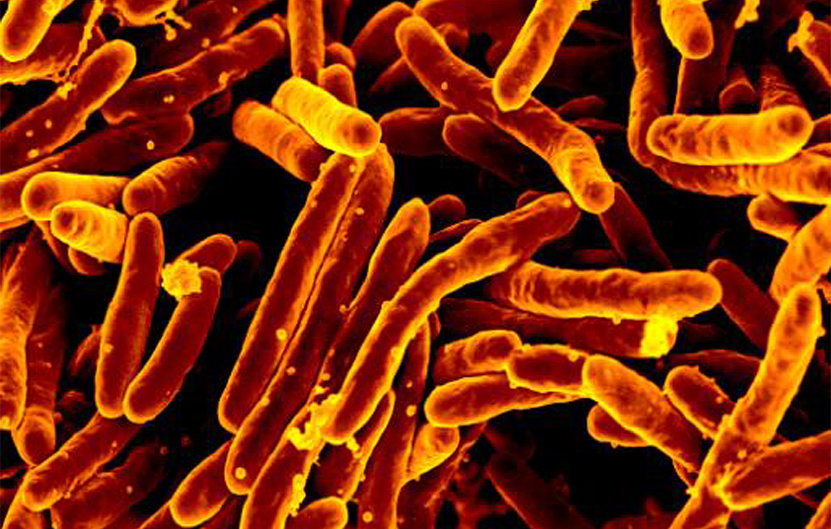 Mycobacterium tuberculosis MEB. Credit: NIAID/Flickr