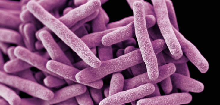 Drug-resistant Mycobacterium tuberculosis