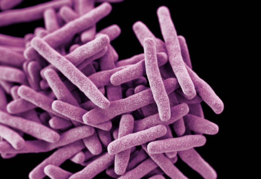 3D-computer generated colorized image of rod-shaped Mycobacterium tuberculosis bacteria. Credit CDC/James Archer