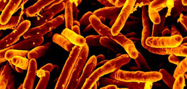 Scanning electron micrograph of Mycobacterium tuberculosis bacteria, which cause TB