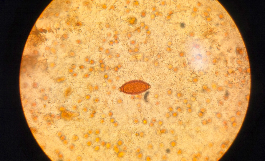 Trichuris as seen with a microscope.