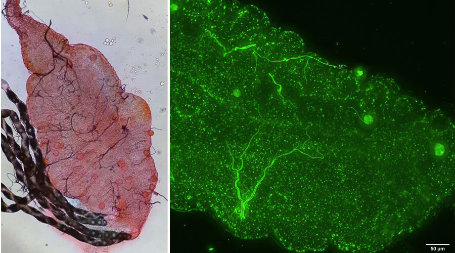 Anopheles mosquito midgut with Plasmodium falciparum oocysts (left), and mosquito midgut showing P. falciparum oocysts expressing mNeonGreen (right)