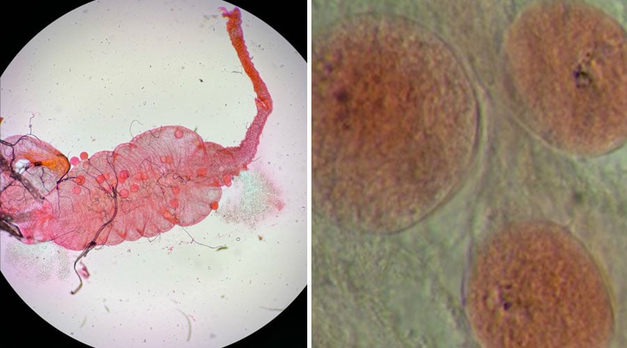 Dissected An. coluzzii midgut showing P. falciparum oocysts (left), and Close -up photograph of mercurochrome-stained P. falciparum oocysts in An. coluzzii (right)
