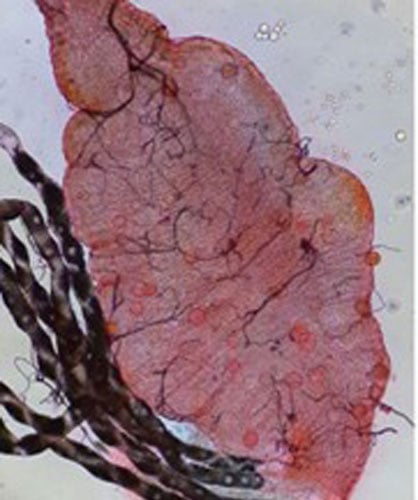 The midgut of a malaria mosquito infected with malaria parasite oocysts