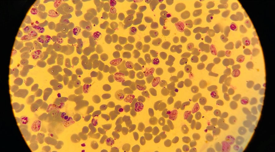 Plasmodium falciparum culture