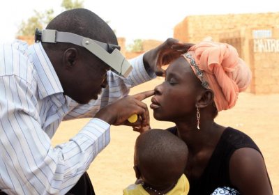 Measuring Trachoma in Burkina Faso. Credit: Alaine Kathryn Knipes; Parasitic Disease Branch (DPDx); Division of Parasitic Diseases and Malaria
