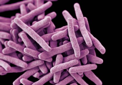 Cluster of Mycobacterium tuberculosis bacteria