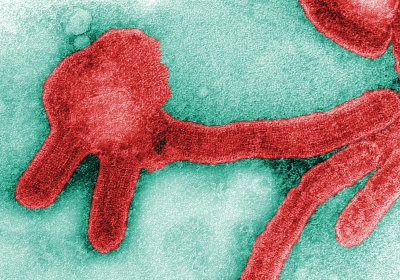 Image: Colorized negative stained transmission electron microscopic image of Marburg virus.