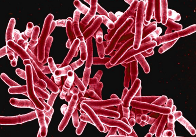 Digitally-colorised-microscopic-image-of-rod-shaped-Mycobacterium-tuberculosis_Credit-CDC-NIAID.png