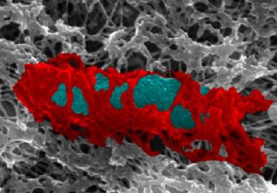 Caption: Inside human cells, septin proteins build cages (red) to trap bacteria (blue) and fight infection. Credit:Serge Mostowy 