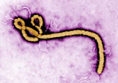 Caption: Ebola virus. Credit: CDC