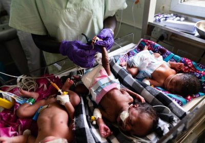 	Three preterm babies admitted to the neonatal unit, Edward Francis Small Teaching Hospital, Banjul