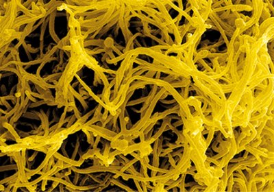 Caption: Colourised scanning electron micrograph of filamentous Ebola virus particles