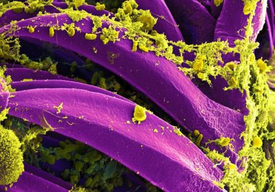 SEM image of Yersinia pestis bacteria on Xenopsylla cheopis flea (cropped for site) | Credit NIAID