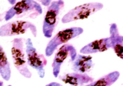 Plasmodium falciparum
