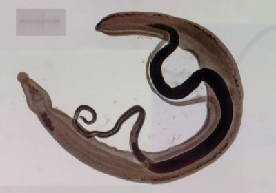 Schistosoma japonicum. Credit: Wikimedia