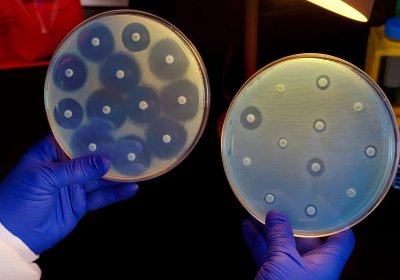 A researcher holds up two culture plates showing bacteria that are susceptible to antibiotics (left) and others that are not (right). Photograph Science History Images Alamy