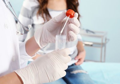 Doctor holds cervical screening test