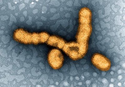 H1N1 influenza particles