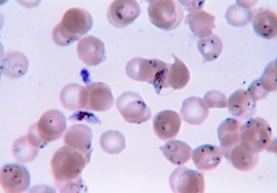 This Giemsa-stained, thin film blood smear photomicrograph reveals the presence of Plasmodium falciparum ring-forms, and gametocytes.