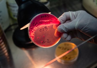 a scientist holding petri dish