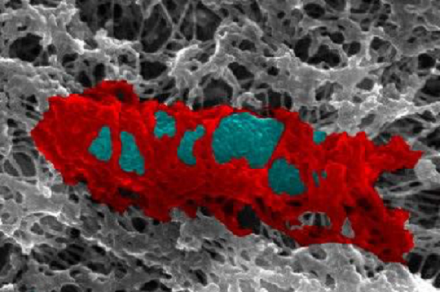 Caption: Inside human cells, septin proteins build cages (red) to trap bacteria (blue) and fight infection. Credit:Serge Mostowy 