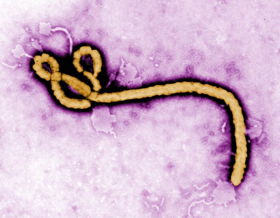 Caption: Ebola virus. Credit. Flickr/CDC