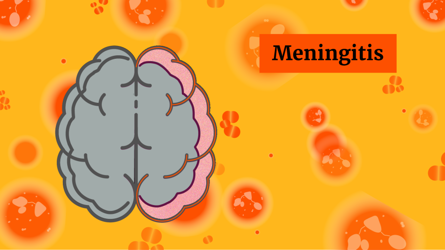 A graphic representing meningitis (inflammation of membranes surrounding the brain)