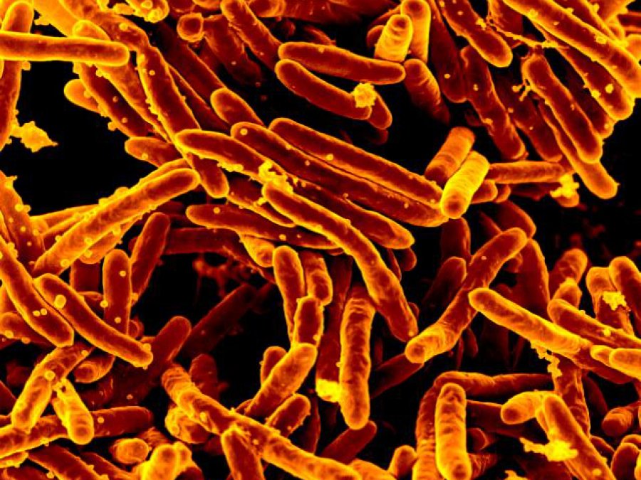 Mycobacterium tuberculosis MEB. Credit: NIAID on Flickr