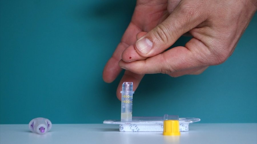 Image: Finger prick test for HIV and syphilis. Credit: SH:24