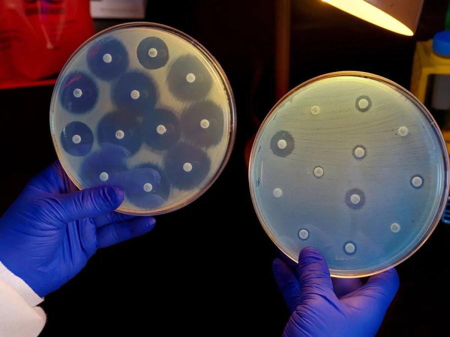 A researcher holds up two culture plates showing bacteria that are susceptible to antibiotics (left) and others that are not (right). Photograph Science History Images Alamy