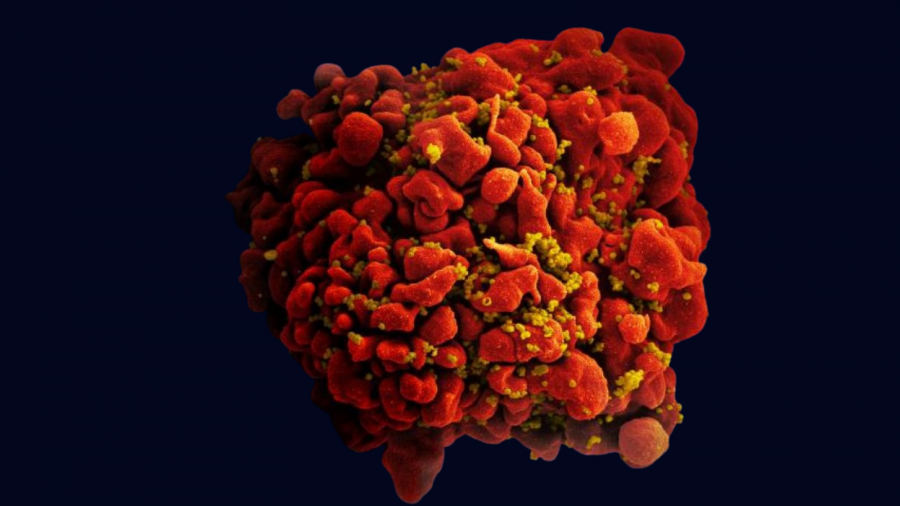 Scanning electron micrograph of an HIV-infected H9 T-cell. Credit: NIAID