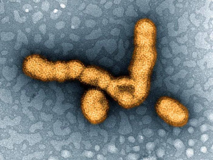 H1N1 influenza particles