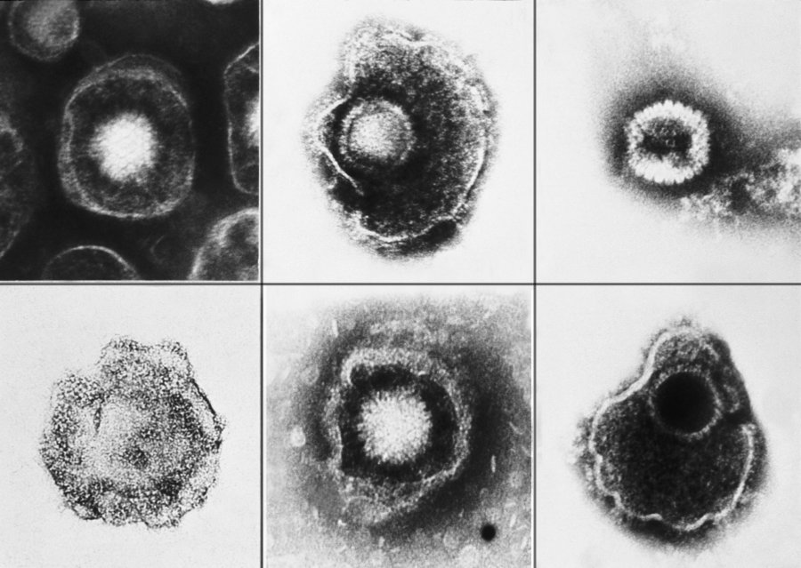 This is an image of the herpes virus