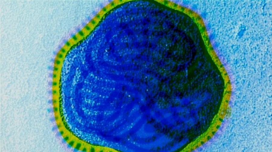 Bacteria