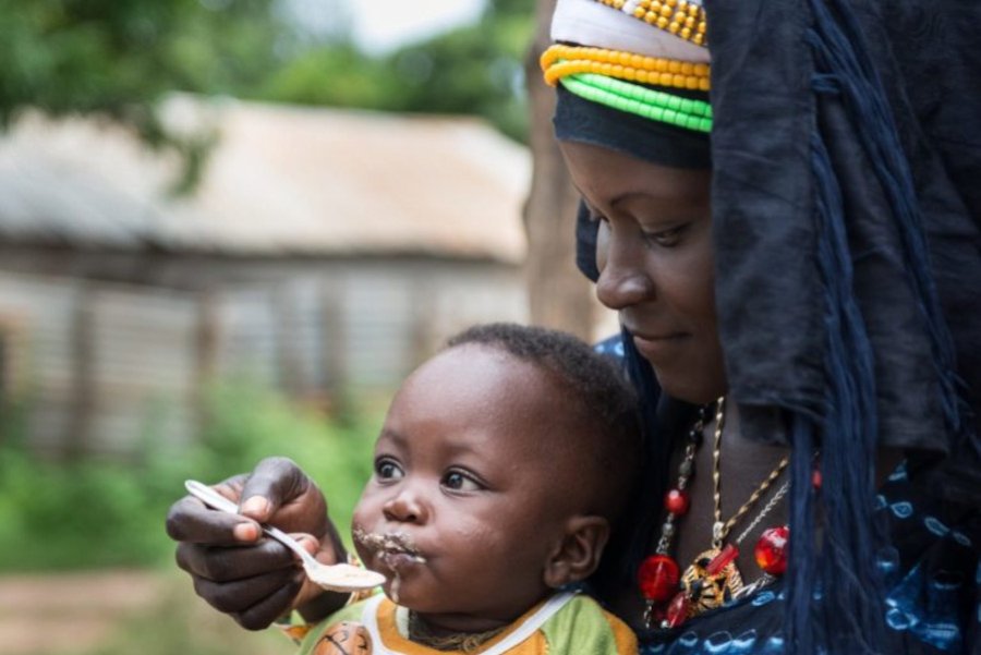 Study explores pathogenesis of acute malnutrition and its severity among children under 5 years