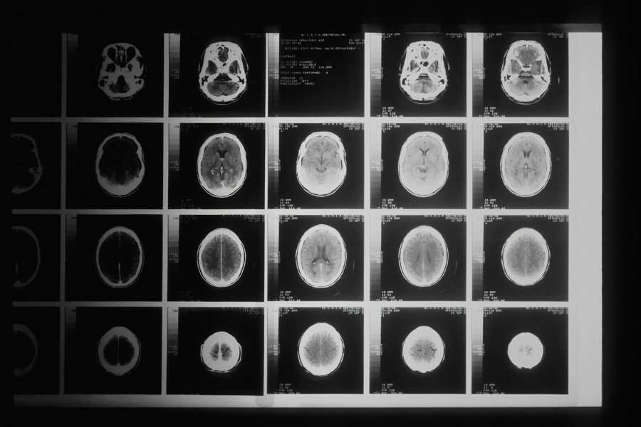 A sheet of different scans of the human brain
