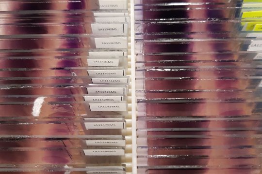 rows of malaria slides 