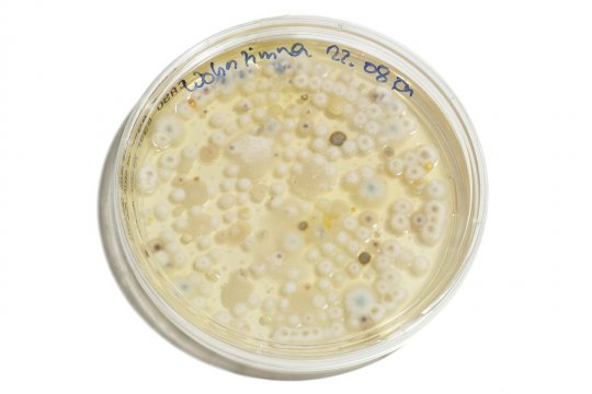 Mould growing in petri dish