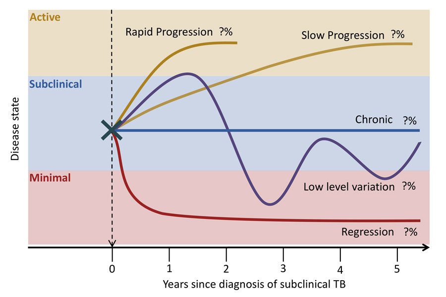 Graph showing the progression of TB