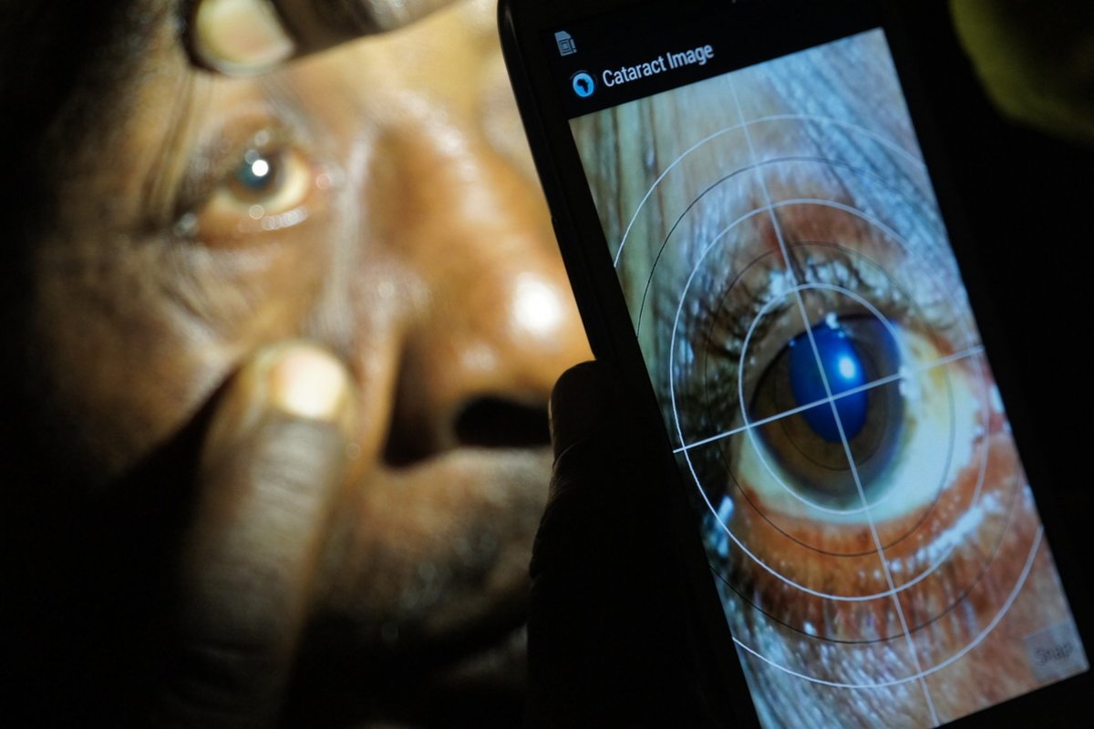 Cataract diagnosis via Peek technology in Kenya. Credit: Peek
