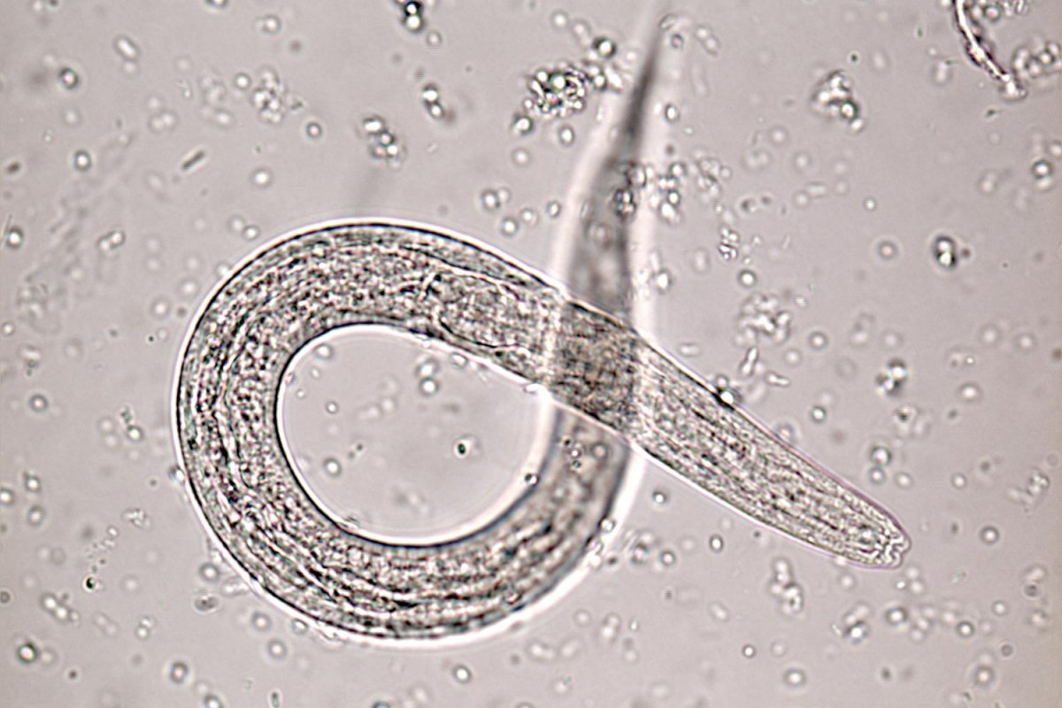 Diagnostic Parasitology Laboratory | Teaching and Diagnostic Unit