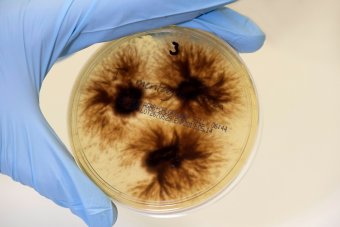 Fungi in a petri dish.
