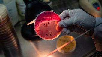 a scientist holding petri dish